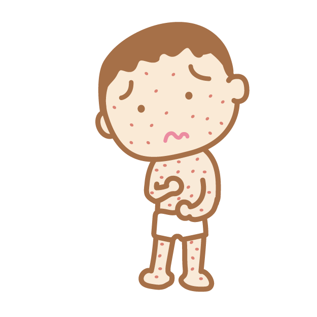 水ぼうそう（水痘）