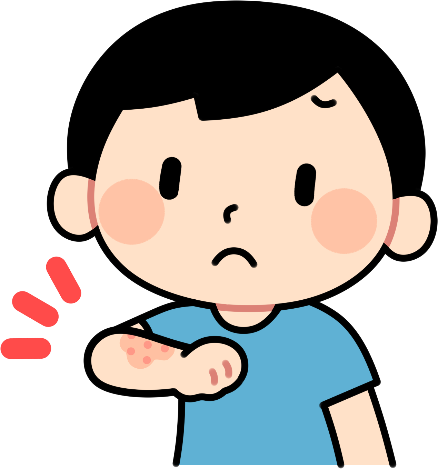 じんましん
