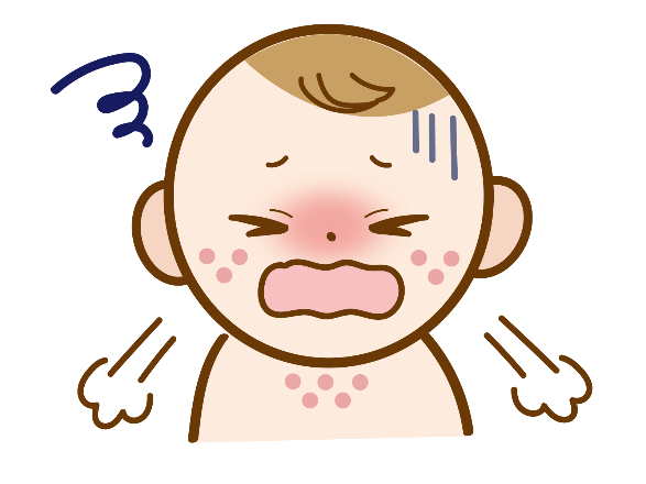 じんましん